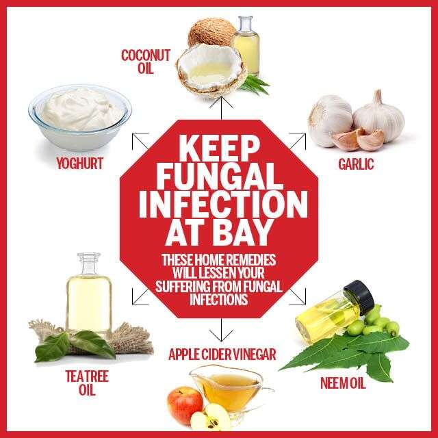 Fungal Infections Home Remedies Infographic
