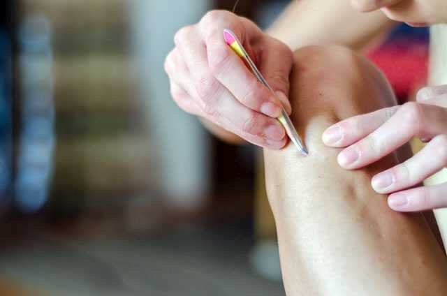 Baking soda for ingrown hair removal