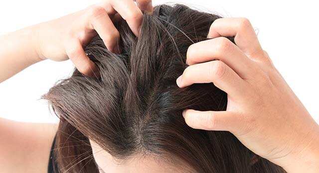 Itchy, scaly scalp can be a result of fatigue