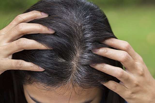 Premature greying can be due to vitamin B deficiency