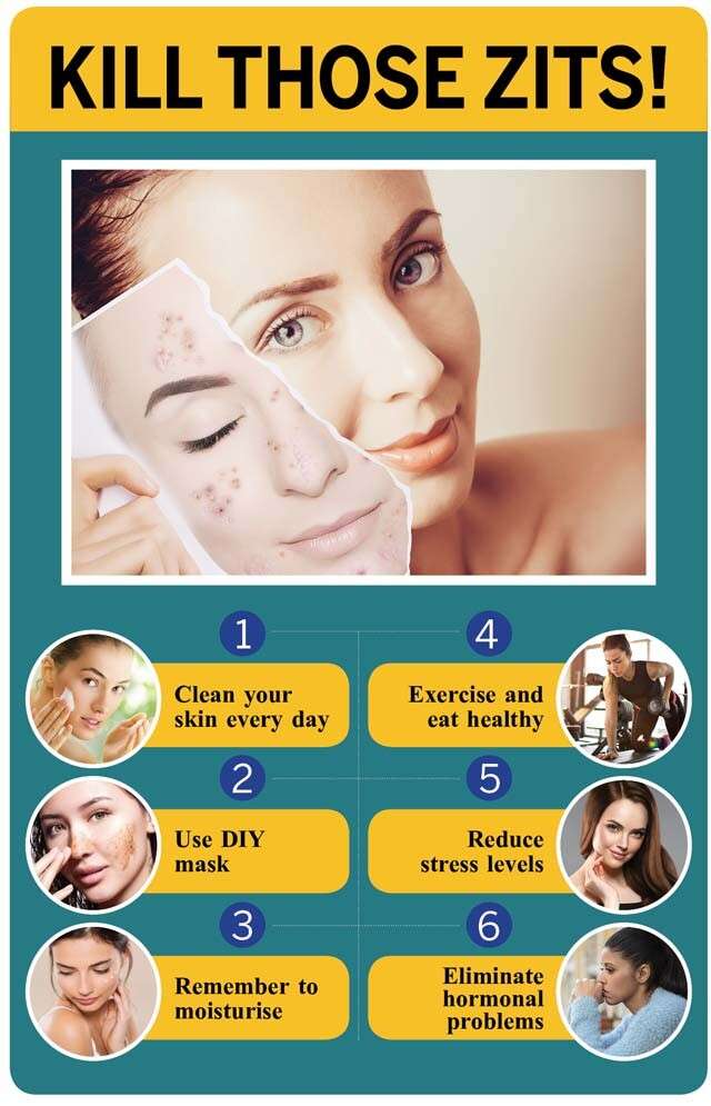 güvenmek slogan ustabaşı  How To Remove Pimples Effectively | Femina.in