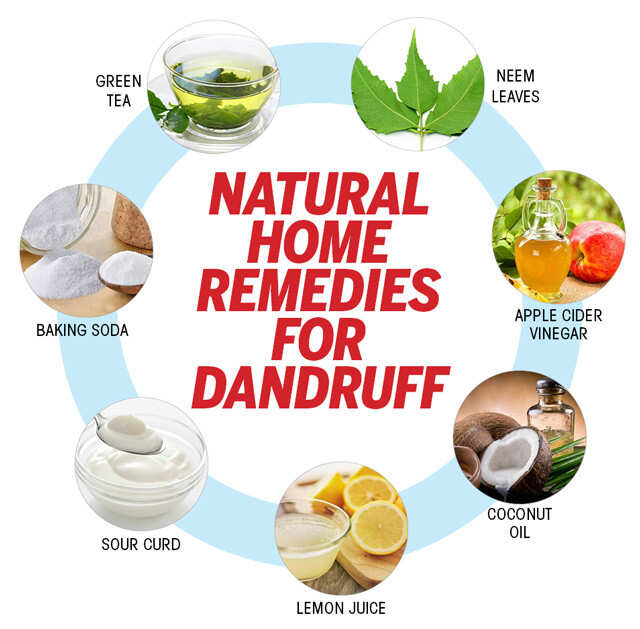 Home Remedies For Dandruff And Itchy Scalp  Feminain