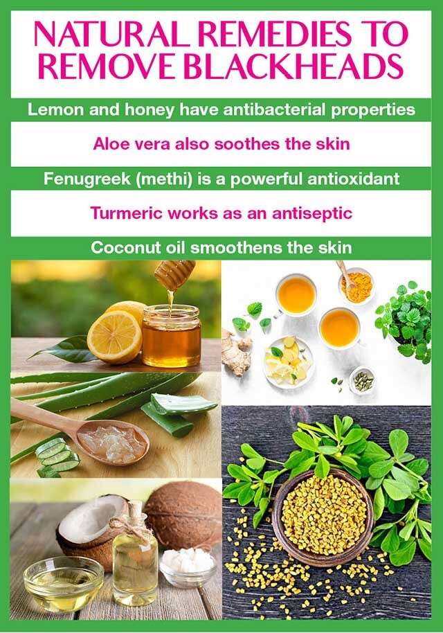 Effective Natural Remedies For Blackheads Removal Femina In