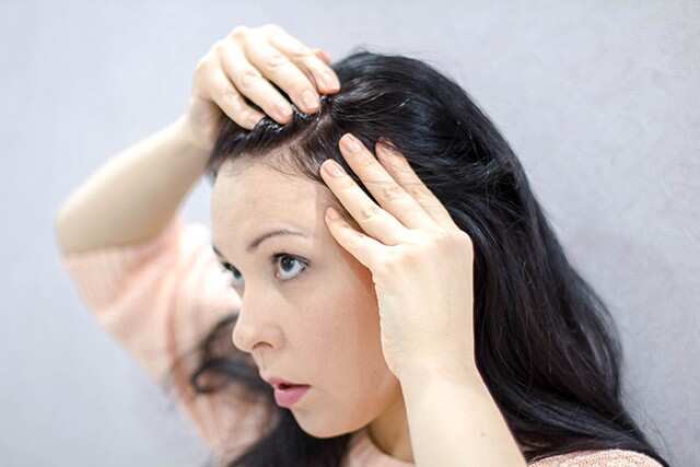 hair fall; Hair Fall Solutions;