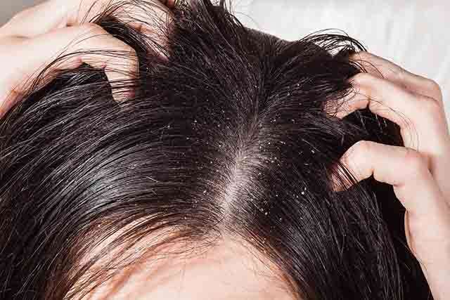 Sunday hair care: Try this curry leaf mask to prevent premature greying |  Life-style News - The Indian Express