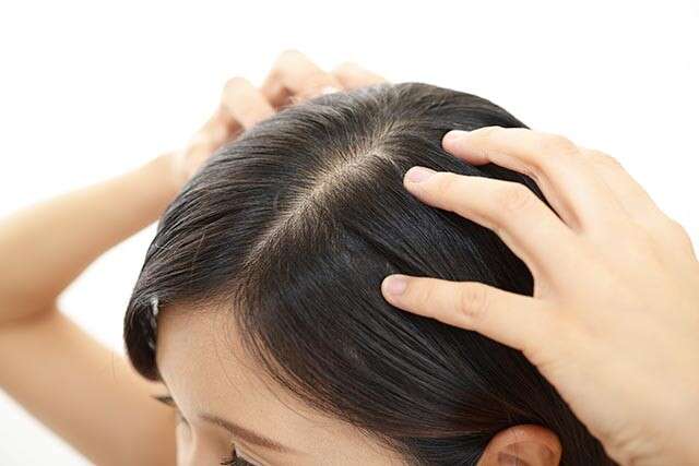HOW TO HIDE THINNING HAIR AT THE FRONT