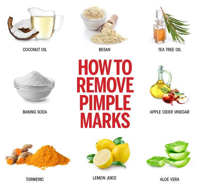 How To Remove Pimple Marks Effective Ways Femina In