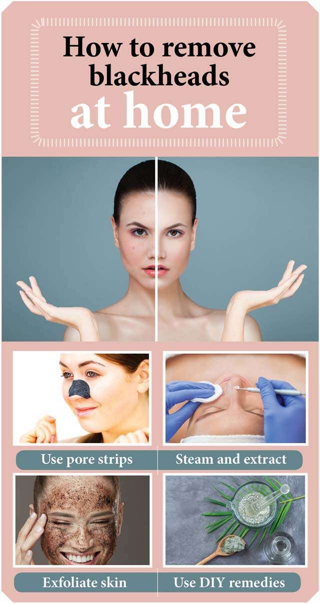Remove Blackheads At Home Infographic