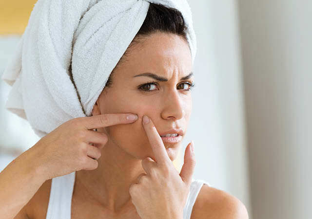 reasons-why-your-skin-is-breaking-out-more-during-quarantine-femina-in