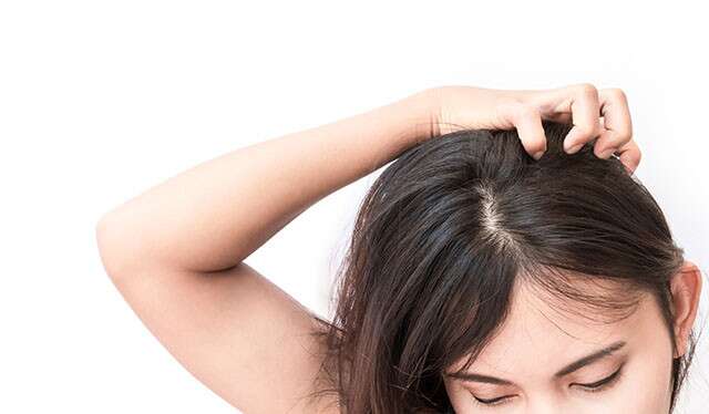 Main Causes Of Dandruff & How To Avoid Them 