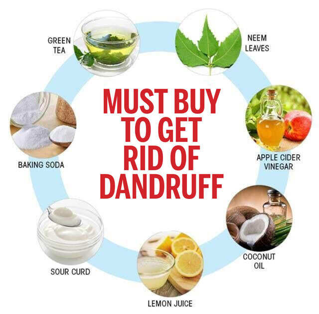 dandruff treatment at home