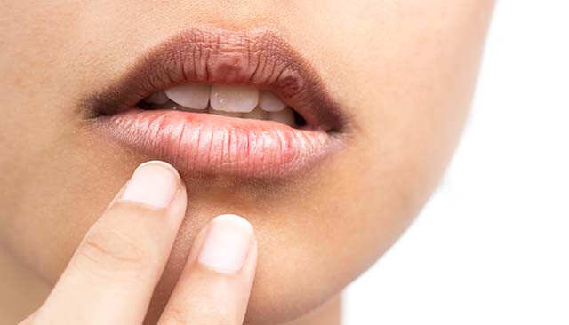 How To Get Pink Lips Naturally With Diy Remedies