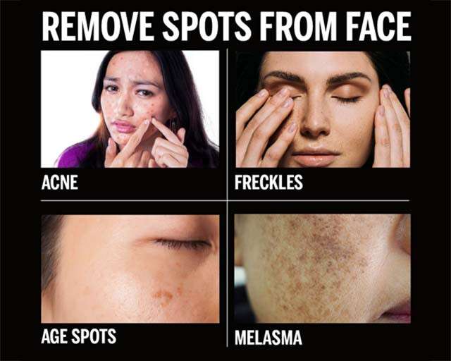 Spots face face on How To