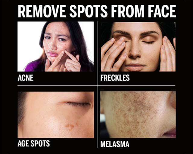 removing marks from face