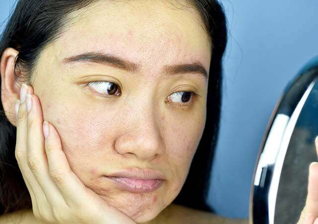 Papaya Facial For Irritated Skin
