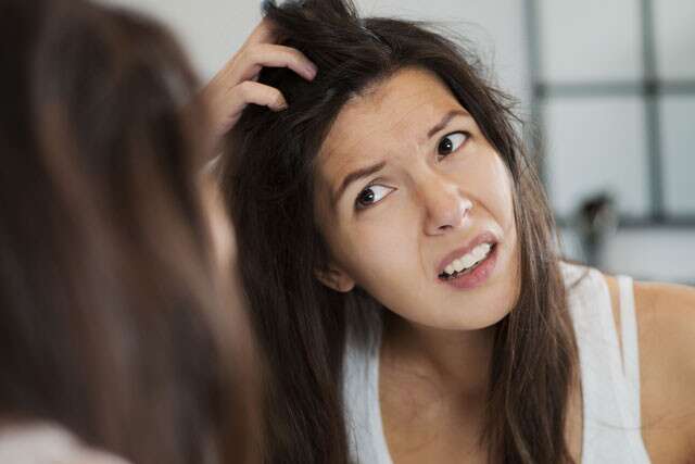 The Causes Of Dandruff