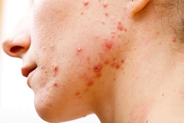 When should I seek medical help for red patches