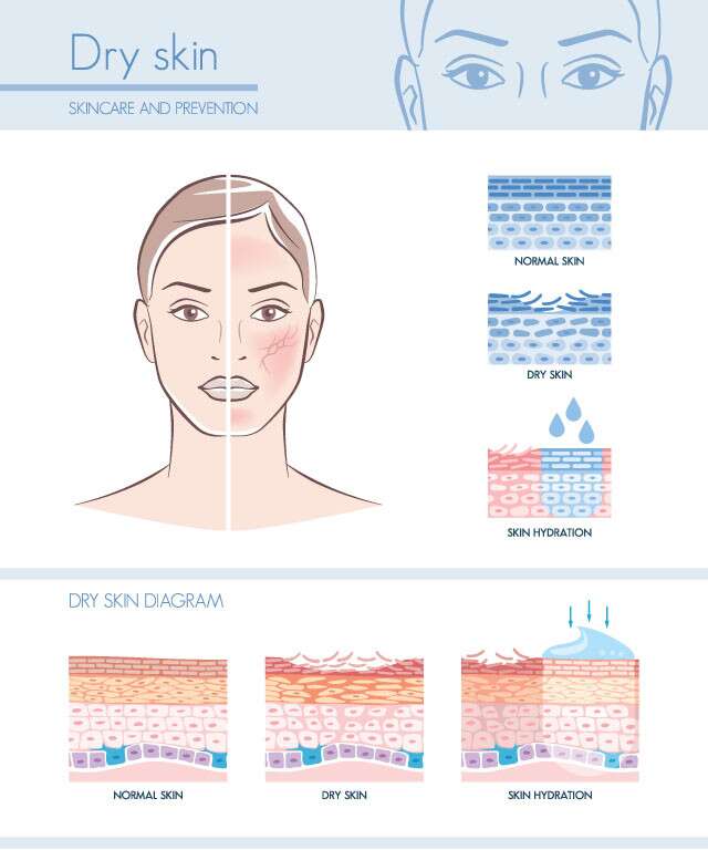 Skincare and Prevention for Dry Skin