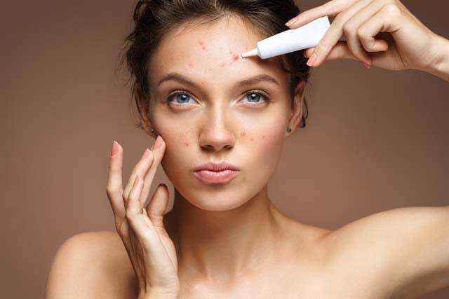 Your Guide To Using Retinol for Acne-Prone Skin | Femina.in