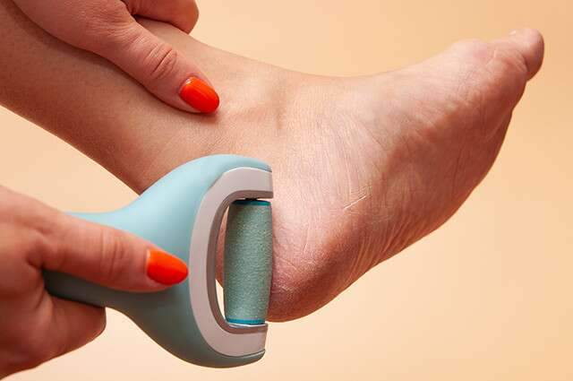 Best Electric Callus Removers to Uncover Healthy Skin
