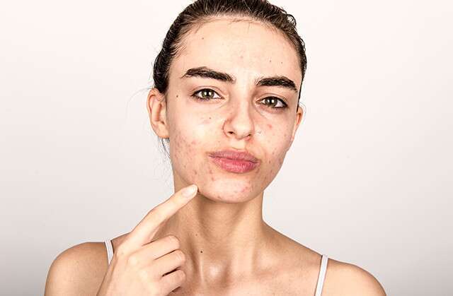 Avoid Facial Massage Exercises When You Have Active Acne