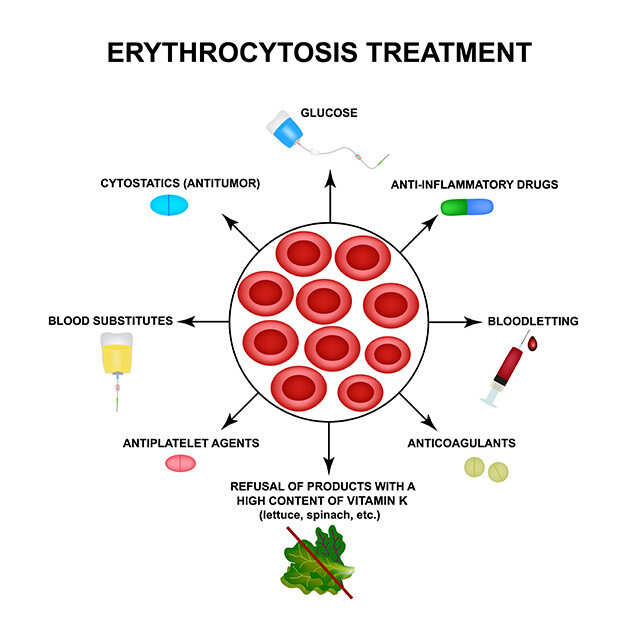 Do not underestimate the power of red blood cell evaluation in