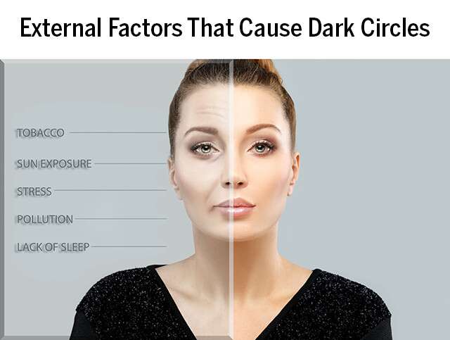 External Factors That Causes Dark Circle