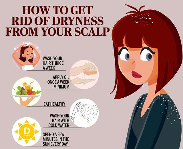 Overview of the home remedies of dandruff and itch scalp infographic