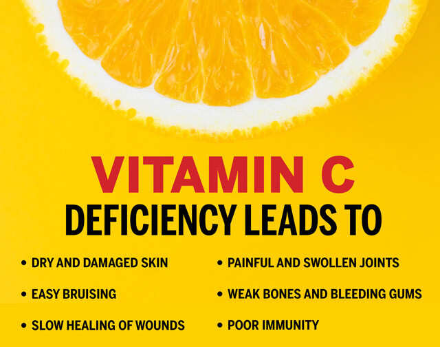 Consume Vitamin C Fruits And Vegetables Femina In