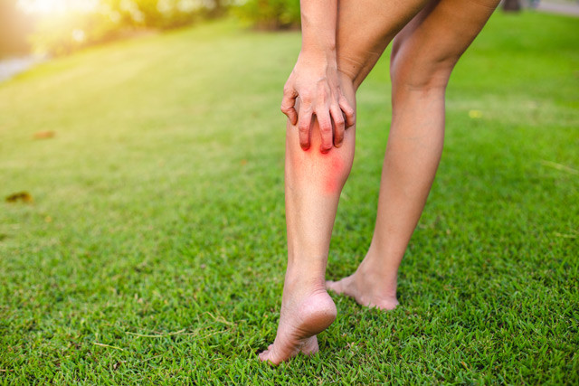 Insect Bites is one of the cause of red spots and bumps on legs.