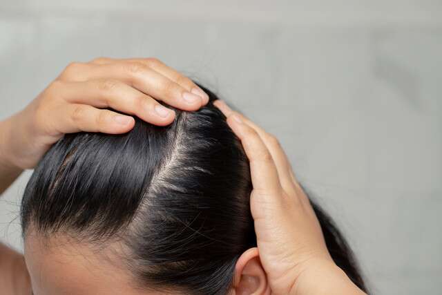 Shikakai for Hair: All The Benefits Plus Best Ways To Use 
