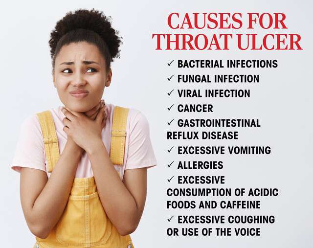 Causes For Throat Ulcer Infographic