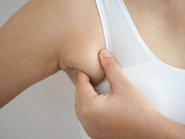 Body Weight Causes Armpit Fat
