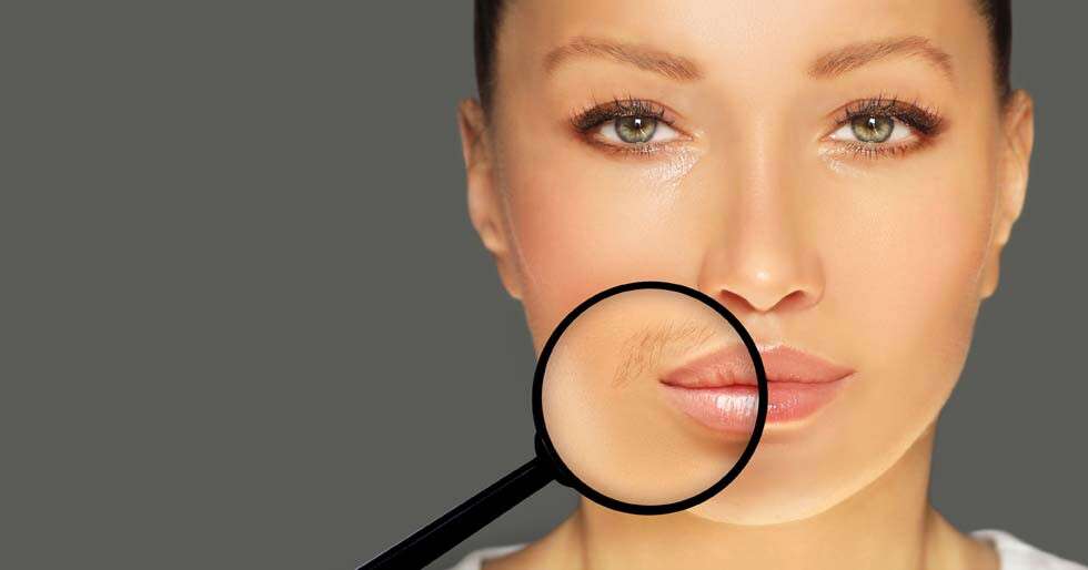 Tried And Tested Methods For Upper Lip Hair Removal 