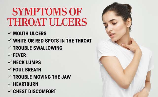 Symptoms For Throat Ulcer