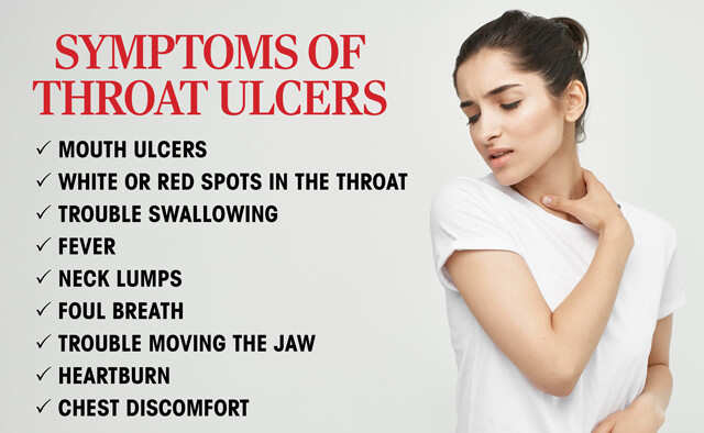 throat ulcers symptoms