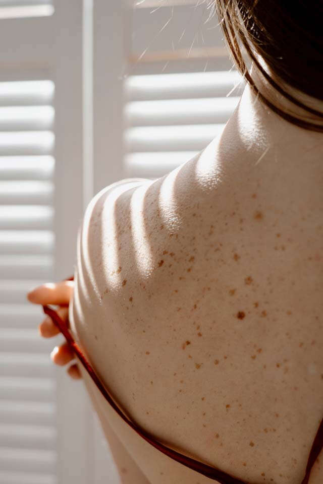 5 At-Home Remedies to Get Rid of Tan on the Face and Body | Femina.in