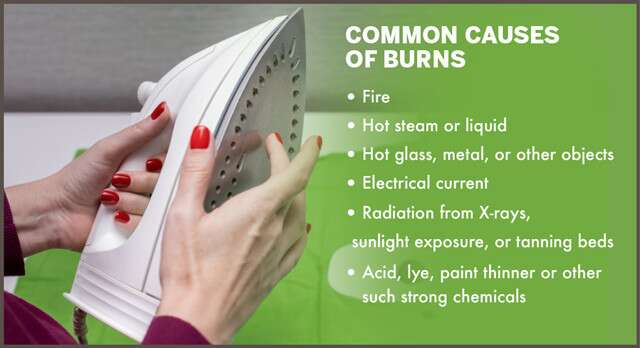 Common Causes Of Burns Infographic