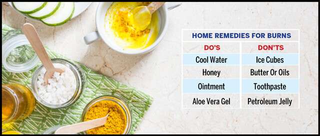 Home Remedies For Burns Infographic