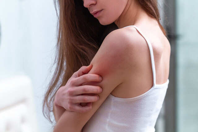 Monsoon Skincare Tips For Itchy Skin