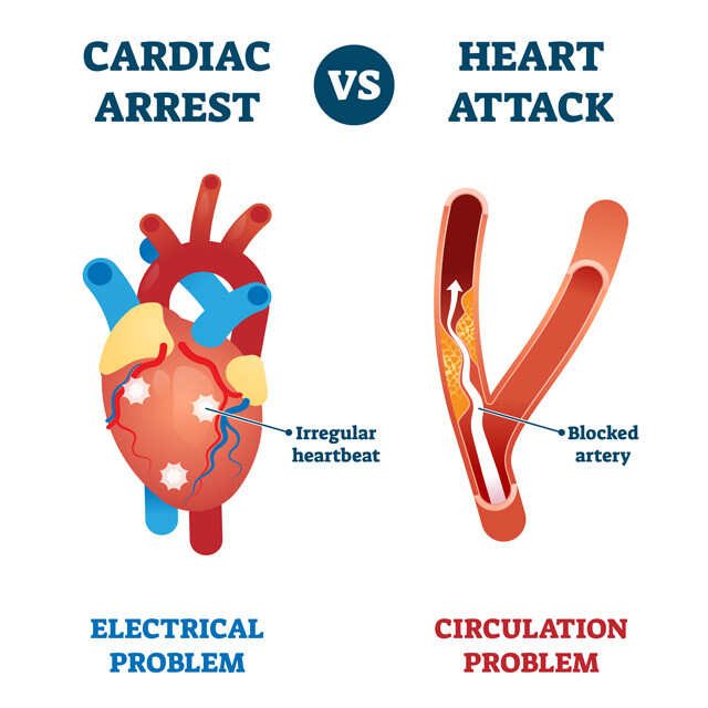 Expert explains heart attack, heart failure, and sudden cardiac arrest - UT  Physicians