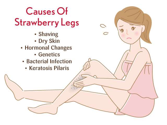 Causes of Strawberry Legs