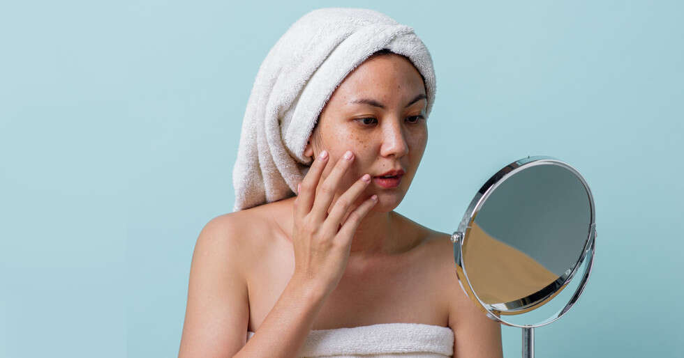 Understanding The Various Types of Dark Spots That Appear On Your Face - Vimarsana News