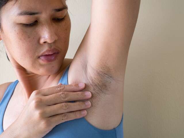 18 Effective ways to get rid of dark armpits