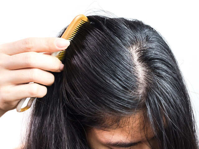 Heres How To Get Rid Of Greasy Hair 