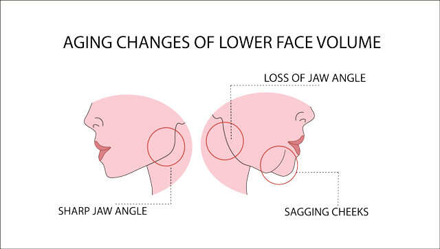 Here’s An Easy Guide On How To Reduce Double Chin | Femina.in