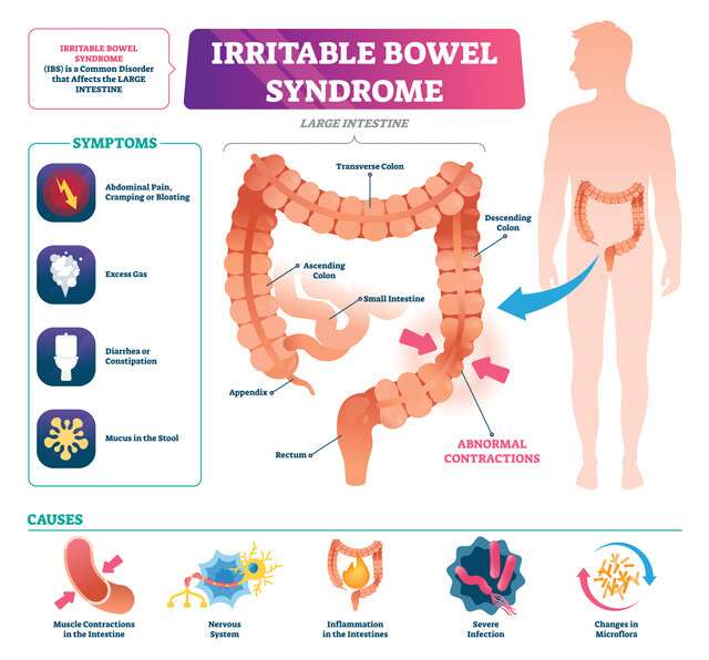 Irritable Bowel Syndrome causes.