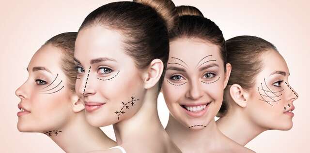 ख़ूबसूरती के लिए चेहरे की सर्जरी कराने से पहले इन बातों को ध्यान में रखें -  Things to consider before undergoing face upliftment surgery | फेमिना हिन्दी