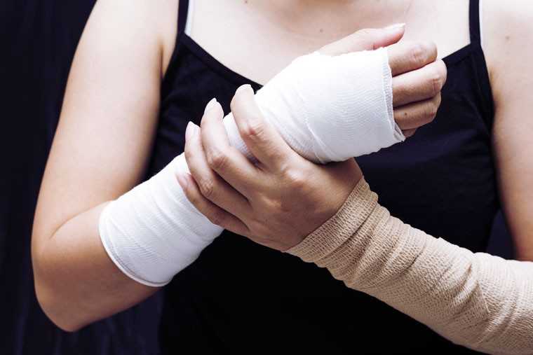 hand fractures