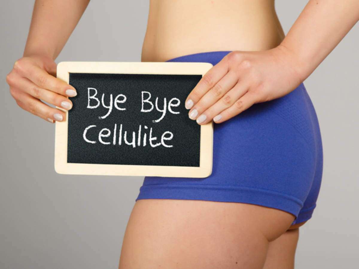 Home Remedies To Treat Stubborn Cellulite Femina In